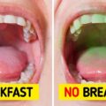 5 Things You Can Do to Get Fresh Breath