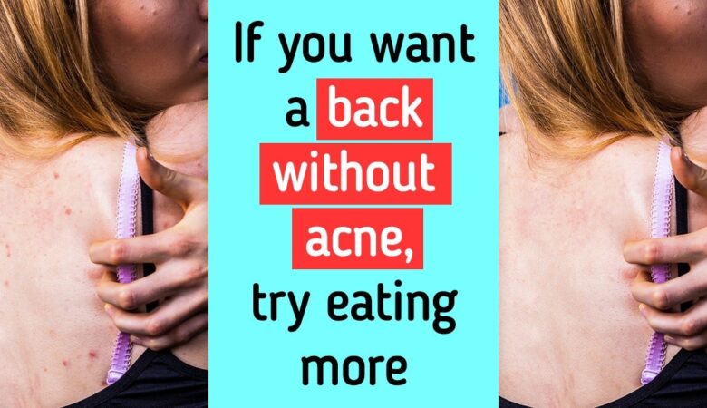 5 Tips to Get Rid of Body Acne and Bring Back Your Confidence