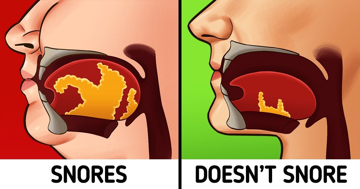 10 Effective Ways to Stop Snoring and Improve Sleep Quality